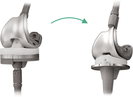 USTAR II | Produits | Genou | United Orthopedic Corporation Suisse